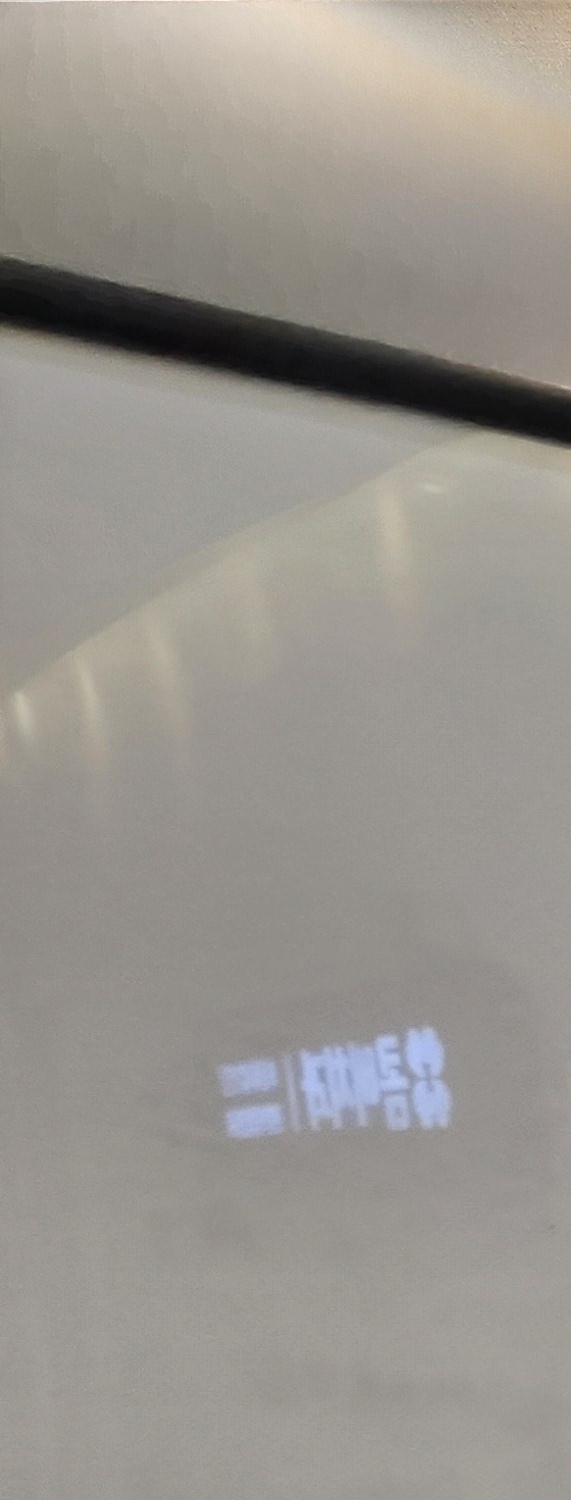 충치 치아 깨짐 시점이 관건이라면 관련 이미지 11