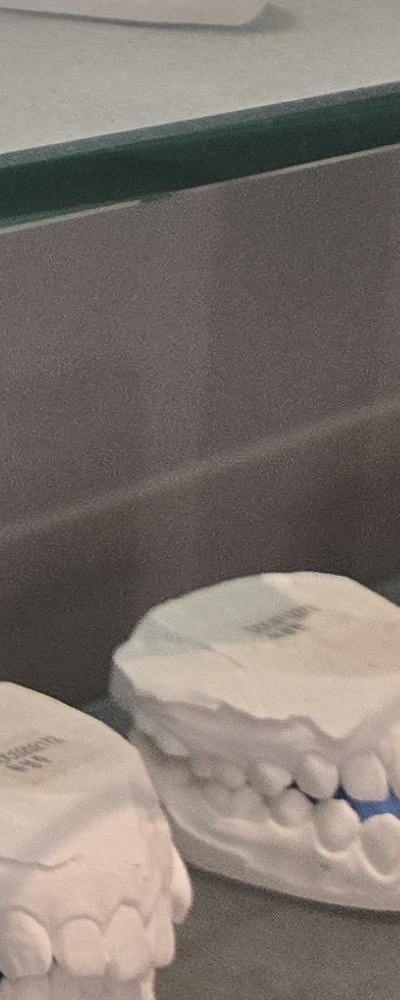 어르신 임플란트 지원 현명하게 활용하려면 관련 이미지 39