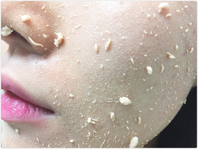 환절기 피부트러블 집에서 간편하게! 관련 이미지 8