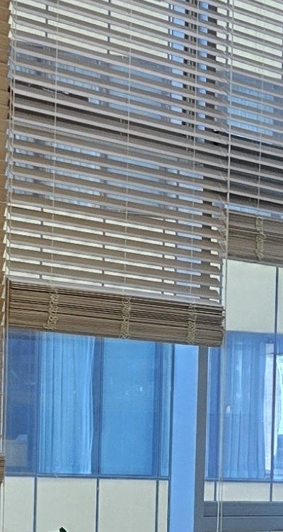 돌출입 팔자주름 교정 얼마나 바뀔까요 관련 이미지 26