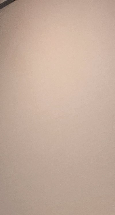 인레이 치료 후 통증 자꾸 심해지는데 괜찮은걸까 관련 이미지 20