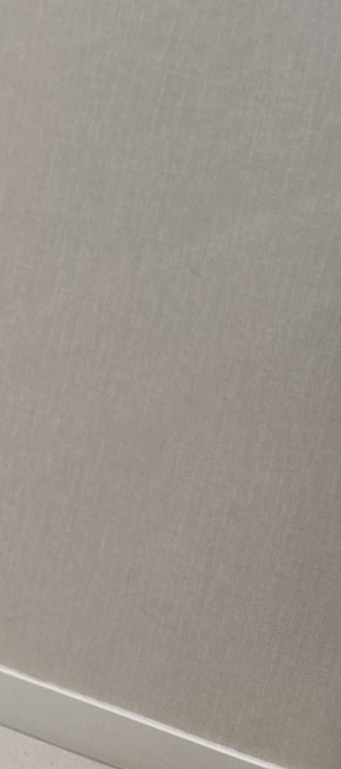 앞니 틀어짐 교정 방법 이럴때는 좀더 간단해요 관련 이미지 20