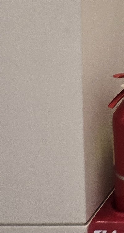 앞니 올세라믹 이건 알고 시작하세요 관련 이미지 41