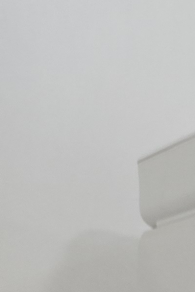 부정교합 교정 안하면 생기는 문제는 뭔가요 관련 이미지 19