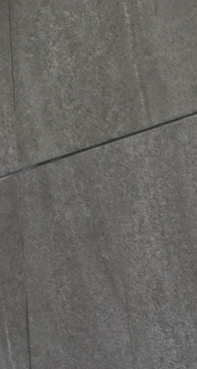 임플란트의 장점 할까 말까 고민이신 분들을 위한 정리 관련 이미지 10