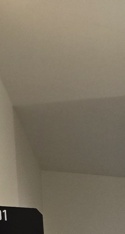 앞니 부분 교정 간단하니까 좋은건가요 관련 이미지 14