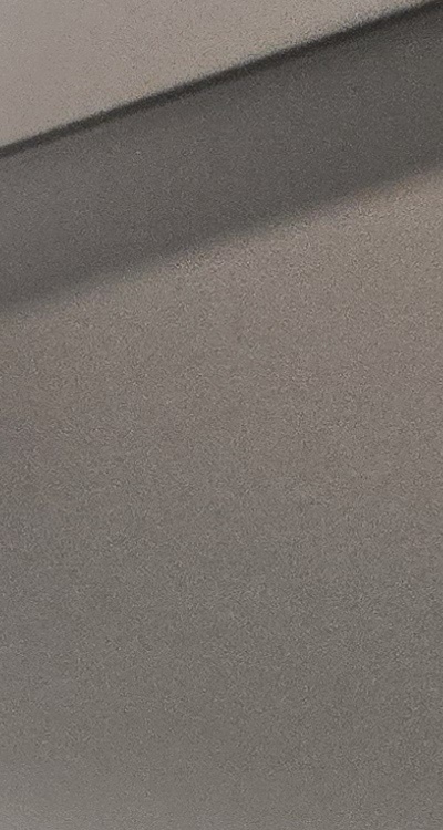 완전매복사랑니 발치 대학병원 꼭 가야하나요 관련 이미지 17