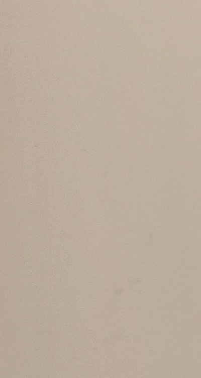 앞니 올세라믹 이건 알고 시작하세요 관련 이미지 22