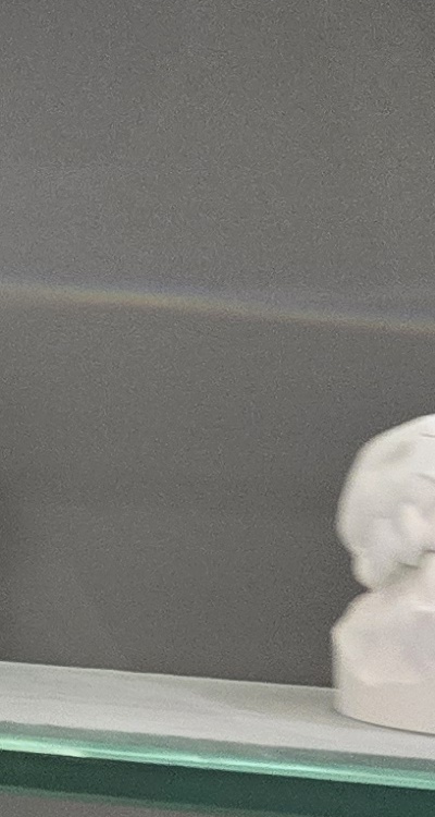 윗니 전체 임플란트 뭐부터 해야할까 관련 이미지 26