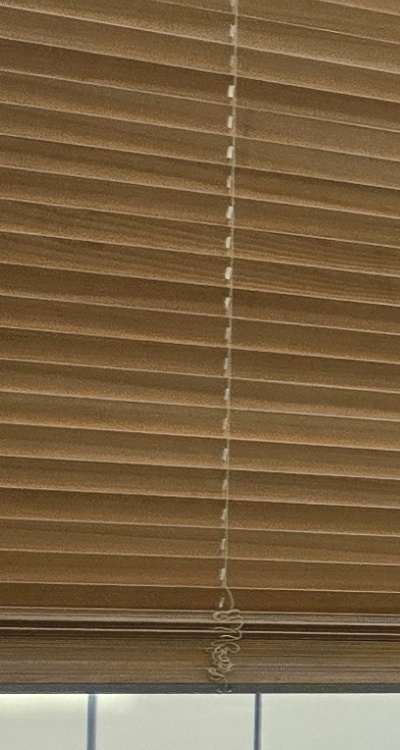 돌출입 팔자주름 교정 얼마나 바뀔까요 관련 이미지 22