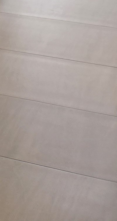 아말감 교체 레진 인레이 어떻게 대처하면 될까 관련 이미지 50