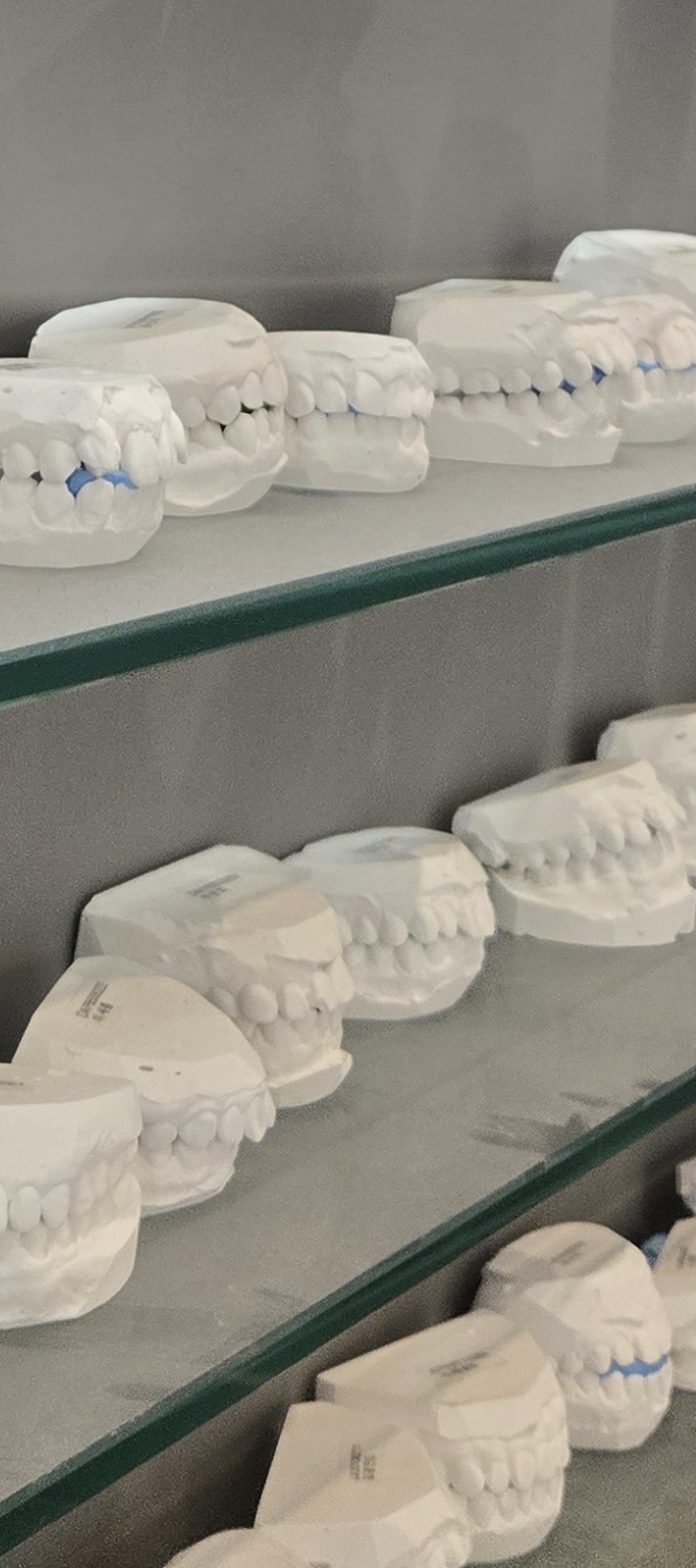 오래된 보철물 아말감 교체 어떠한 케이스일까 관련 이미지 19