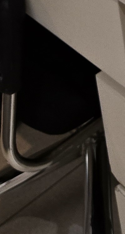 신경치료 아픈가요 망설이시는 분들이라면 관련 이미지 43