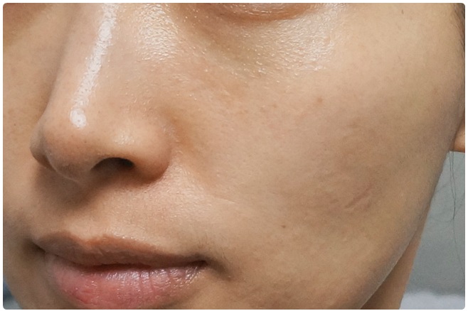 물광피부 리얼이라구! 관련 이미지 7