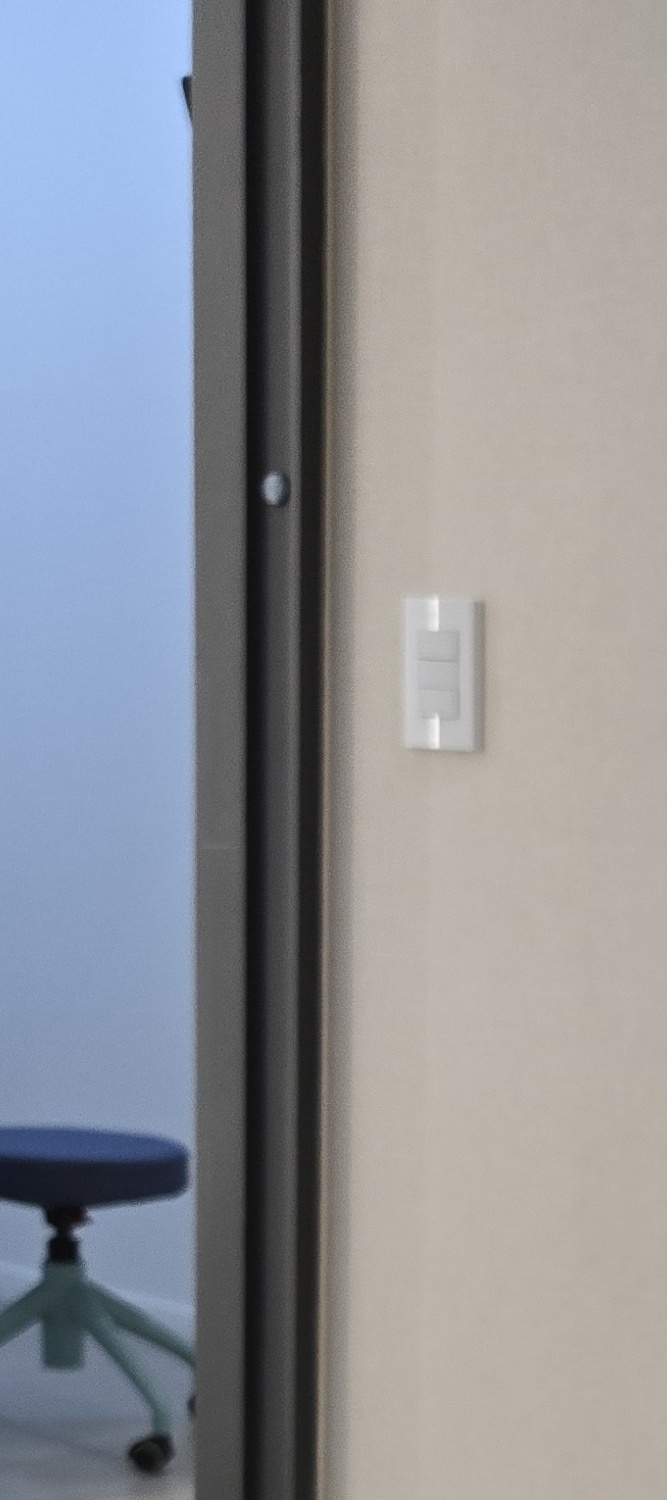 앞니 틀어짐 교정 방법 이럴때는 좀더 간단해요 관련 이미지 10