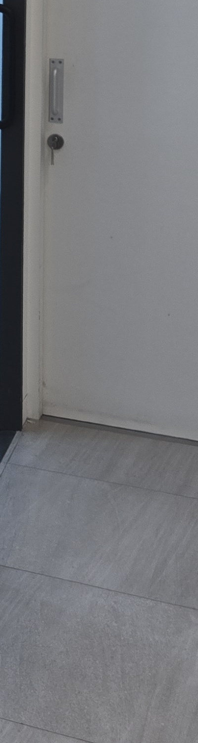 어금니 없으면 얼굴 발음에 어느정도나 안좋을까 관련 이미지 32