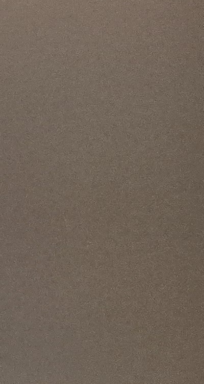 인레이 치료 후 통증 자꾸 심해지는데 괜찮은걸까 관련 이미지 41