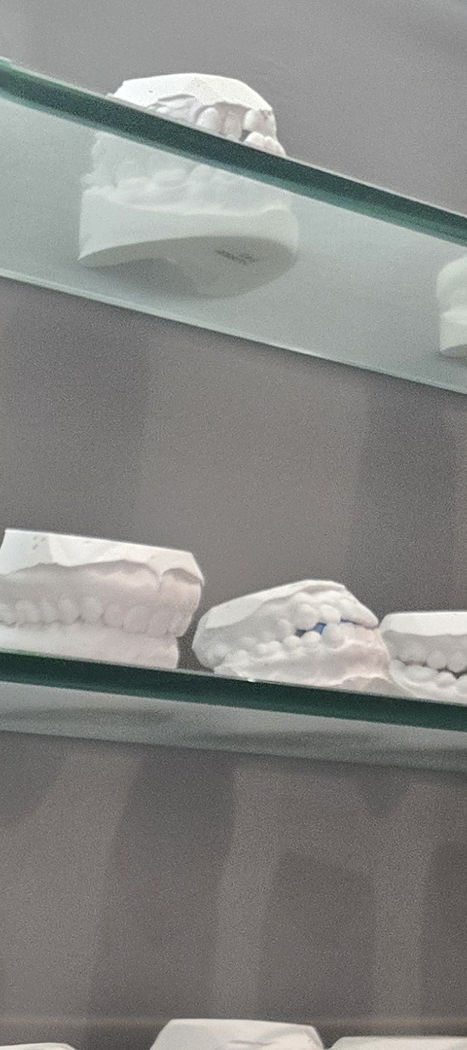 앞니 틀어짐 교정 이렇게 파악하세요 관련 이미지 14