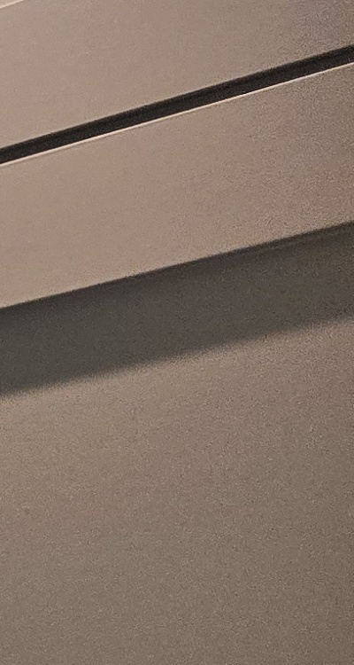 인레이 치료 후 통증 자꾸 심해지는데 괜찮은걸까 관련 이미지 31