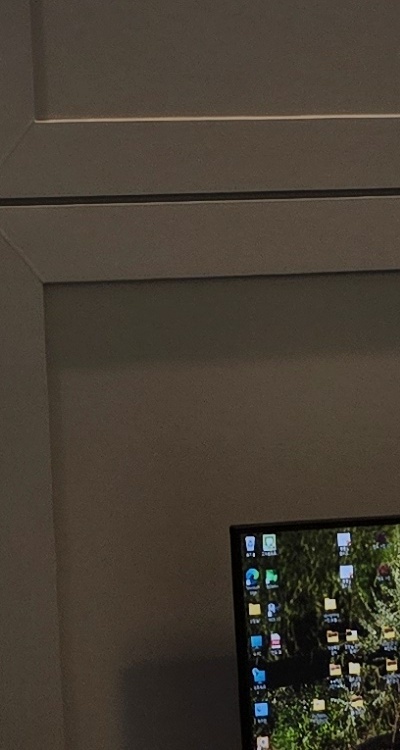 반대교합 치아교정 해결 가능할까 관련 이미지 44