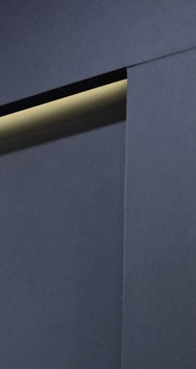 치아 발치 후 임플란트 언제부터 준비할까 관련 이미지 18