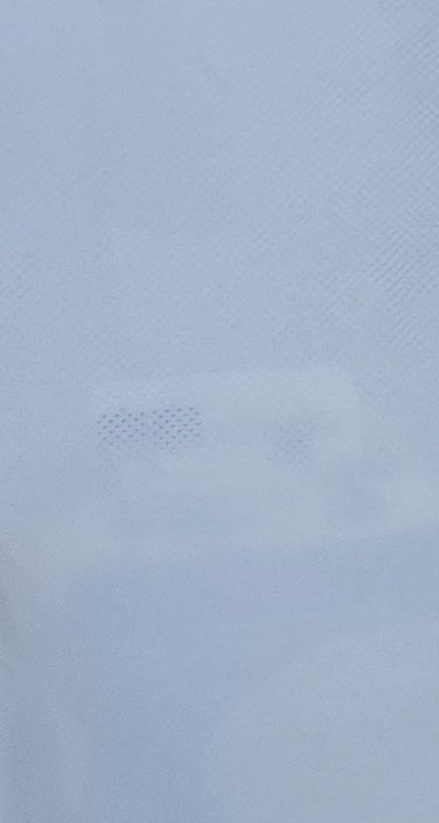 사랑니 발치 후 충치 치료 둘다 준비하려면 관련 이미지 32