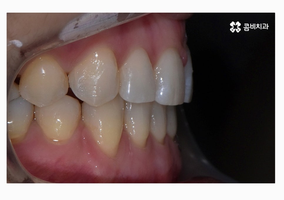콤비교정 합리적으로 판단하려면 관련 이미지 16