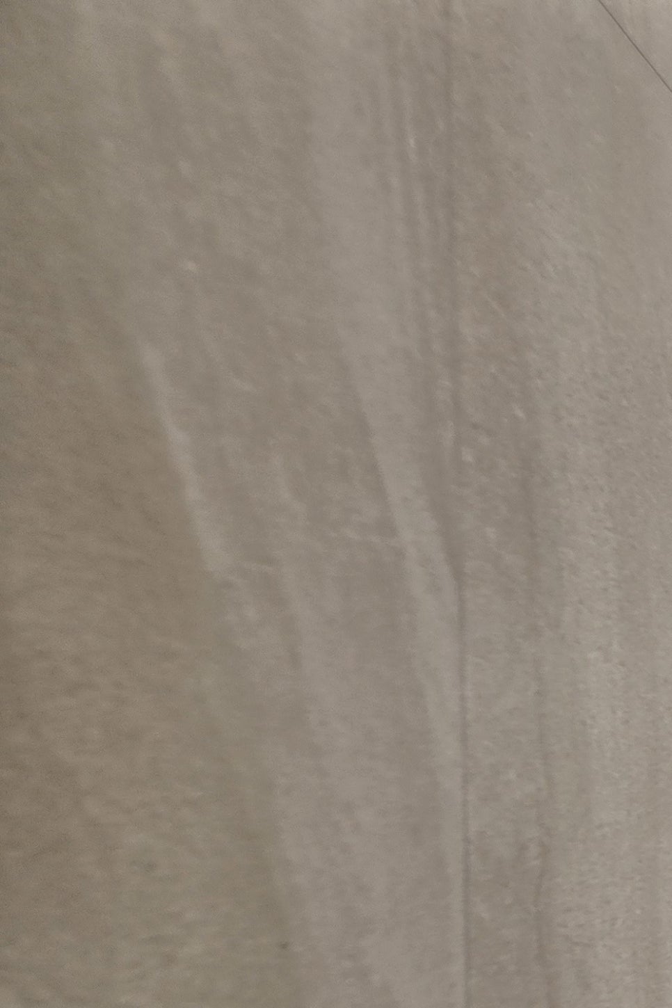 어금니 임플란트 과정 제대로 이해하려면 관련 이미지 23