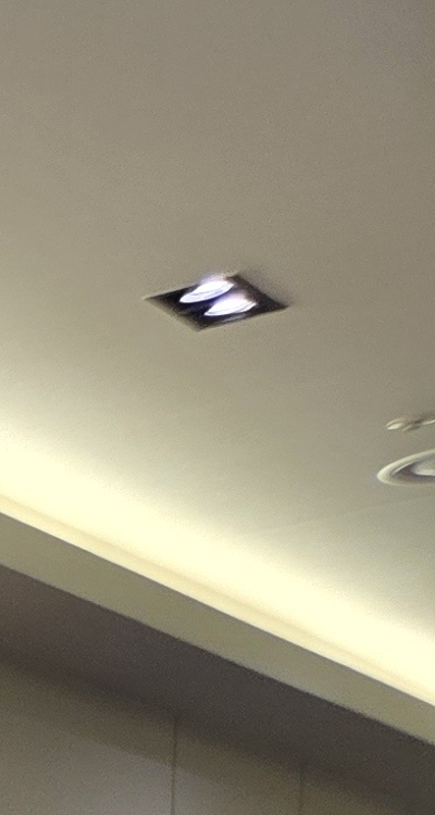 임플란트 뼈이식 안하면 어떤 문제가 있는거죠 관련 이미지 22