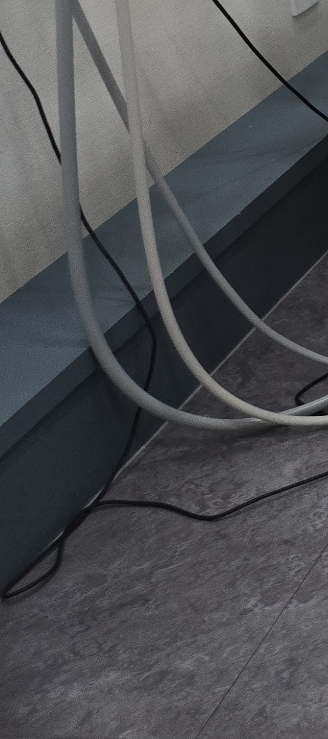 비발치 돌출입 교정 어떨때 적절할까 관련 이미지 16