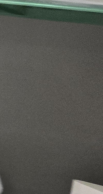 윗니 전체 임플란트 뭐부터 해야할까 관련 이미지 38