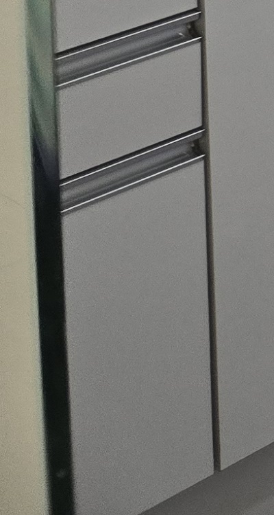 50대임플란트 꼼꼼하게 따져봐야할 포인트는 관련 이미지 42