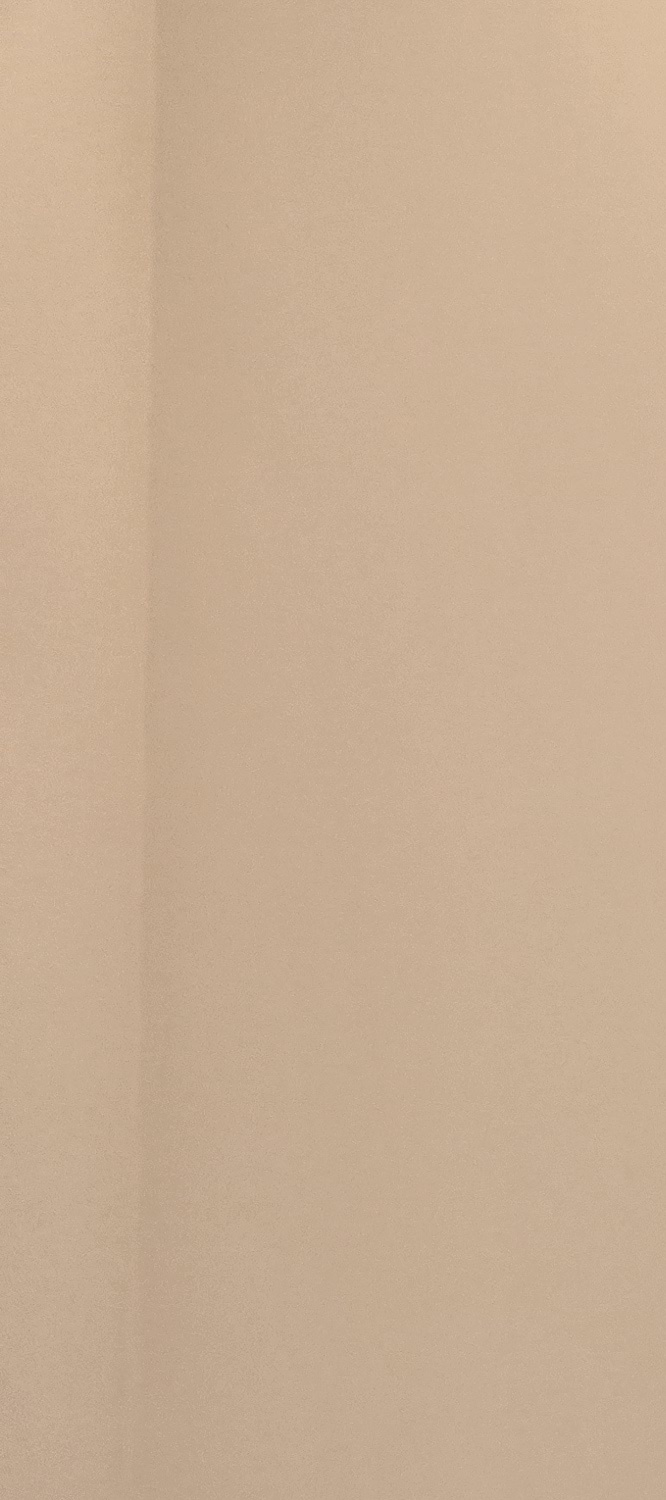 아말감 교체 시기 이렇게 따져보세요 관련 이미지 13