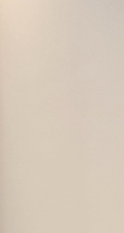 앞니 올세라믹 이건 알고 시작하세요 관련 이미지 13