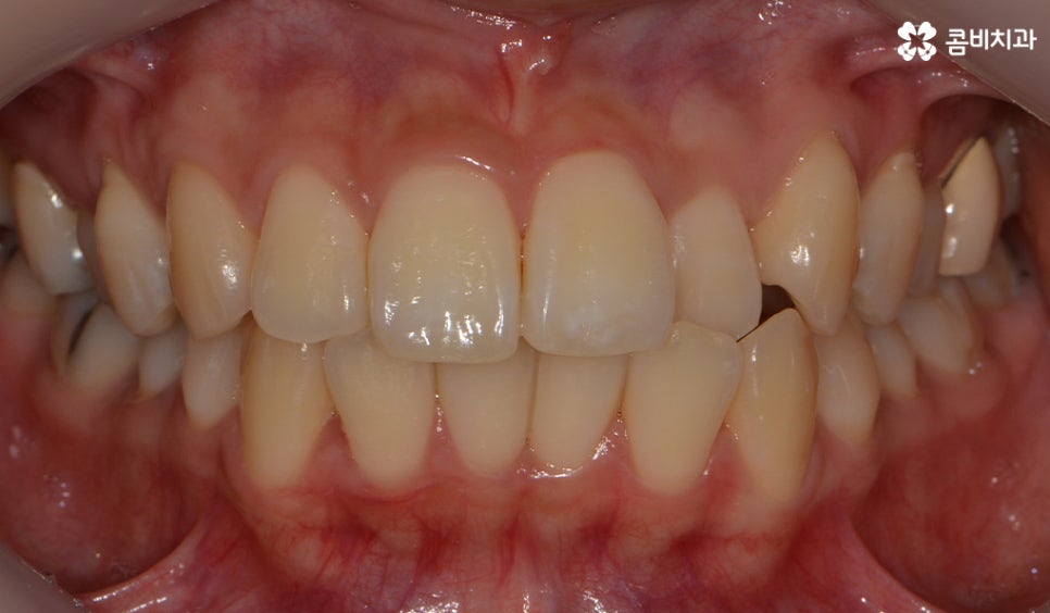 콤비교정 나에게 적합한지 판단하려면 관련 이미지 3