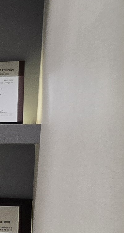 아래 사랑니 발치 통증 미리 알고 대처하려면 관련 이미지 28