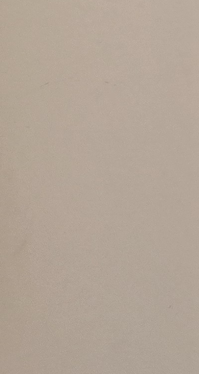 앞니 올세라믹 이건 알고 시작하세요 관련 이미지 32