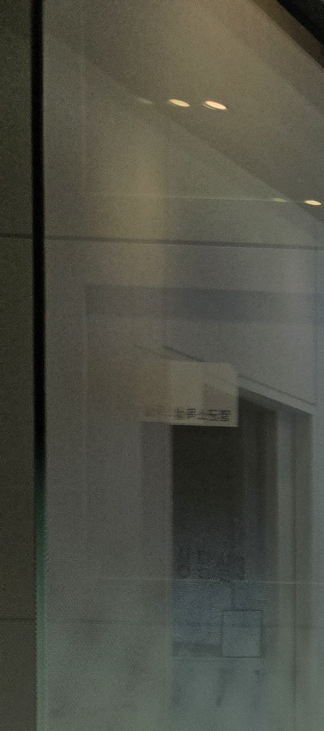 윗니만 교정 간단하게 끝내려면 관련 이미지 14