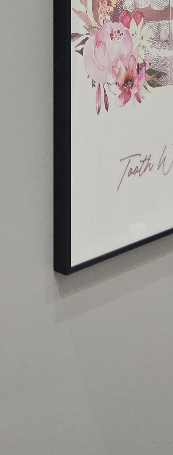 앞니 크라운 교체 깔끔하게 정리하려면 관련 이미지 39