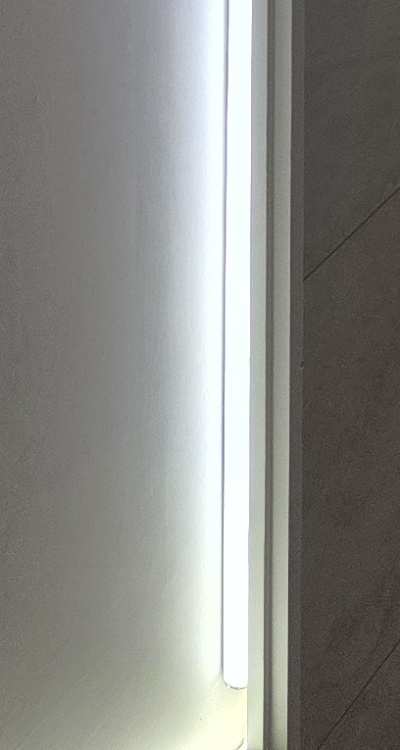 앞니 틀어짐 교정 조화롭게 마무리하려면 관련 이미지 44