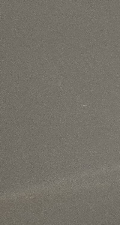 앞니 틀어짐 부분교정 얼마나 걸릴까 관련 이미지 32