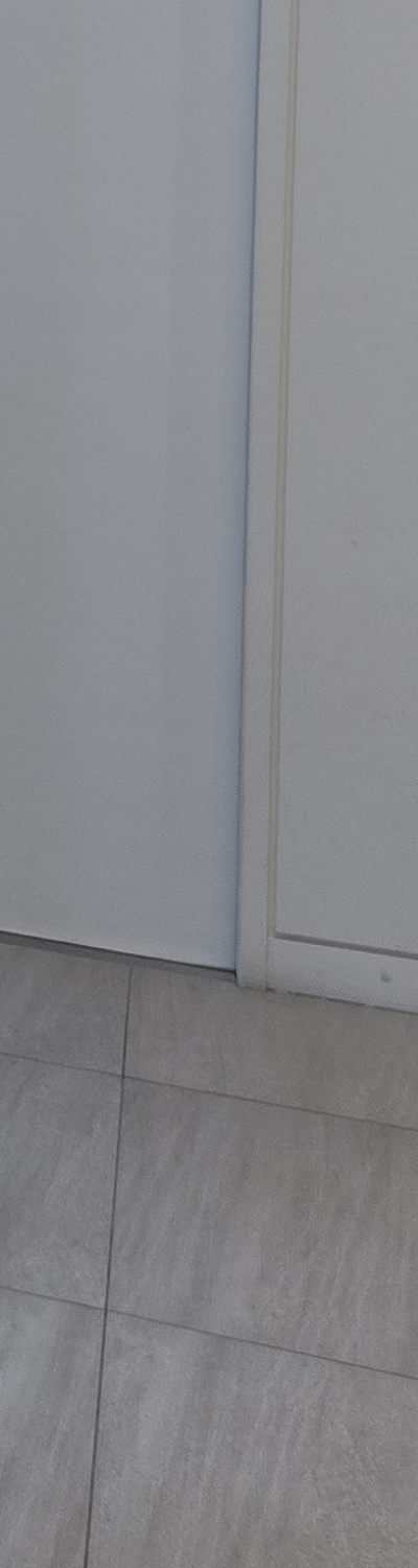 어금니 없으면 얼굴 발음에 어느정도나 안좋을까 관련 이미지 33