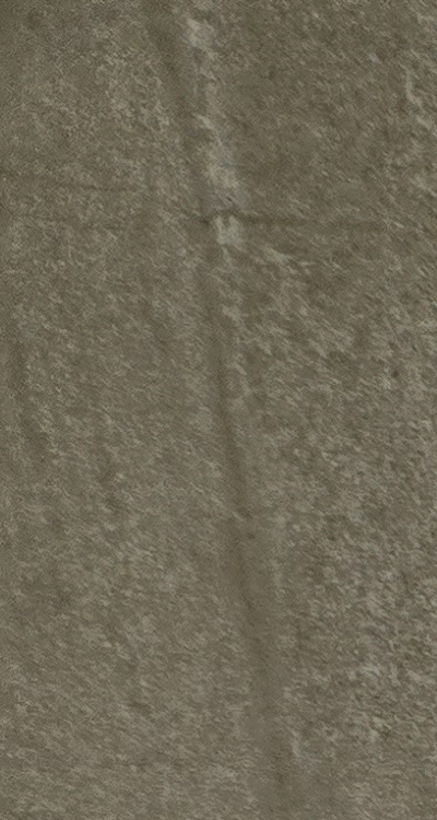 앞니 신경치료 크라운 까지 해야할 상황이라면 관련 이미지 11