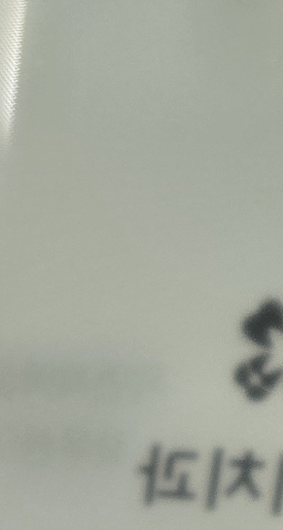 신경치료 아픈가요 망설이시는 분들이라면 관련 이미지 18