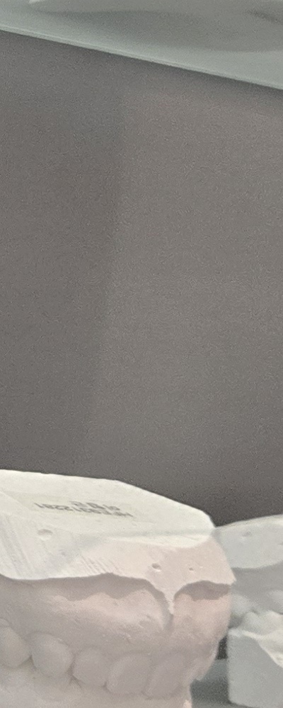 어르신 임플란트 지원 현명하게 활용하려면 관련 이미지 28