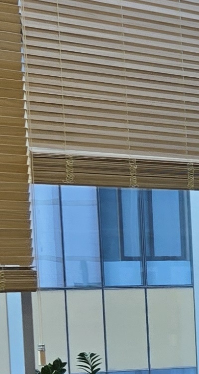 임플란트 뼈이식 안하면 어떤 문제가 있는거죠 관련 이미지 25