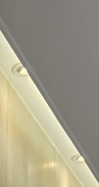 앞니 신경치료 크라운 까지 해야할 상황이라면 관련 이미지 18