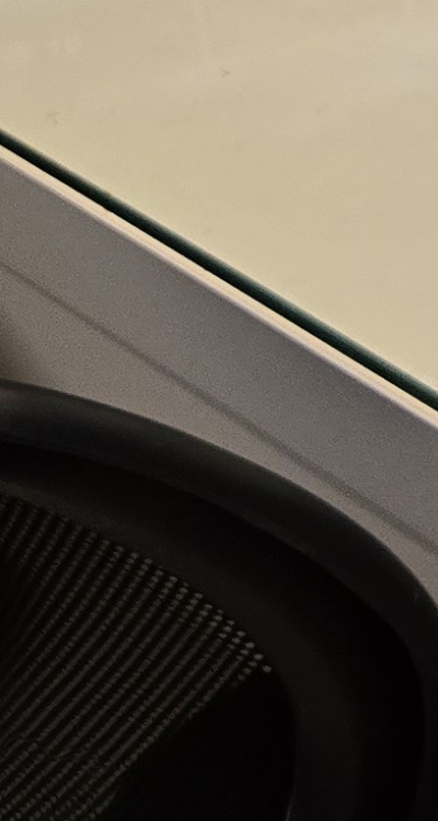 신경치료 아픈가요 망설이시는 분들이라면 관련 이미지 32