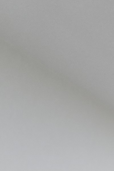 부정교합 교정 안하면 생기는 문제는 뭔가요 관련 이미지 12