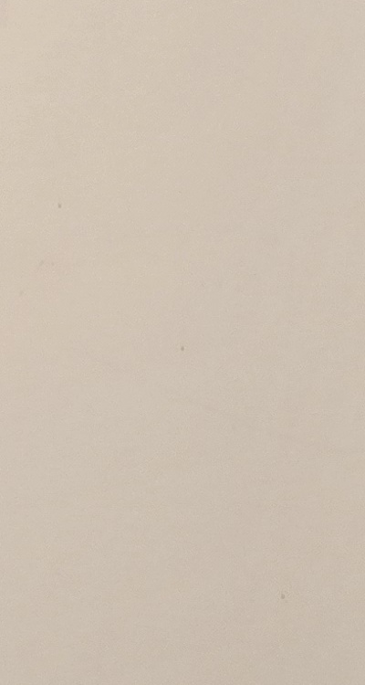 앞니 올세라믹 이건 알고 시작하세요 관련 이미지 35